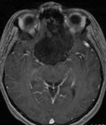 Dr. Mustafa K. Baskaya, MD tweet media