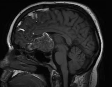 Dr. Mustafa K. Baskaya, MD tweet media