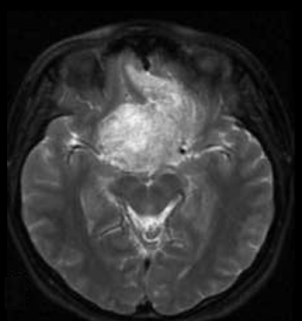 Dr. Mustafa K. Baskaya, MD tweet media