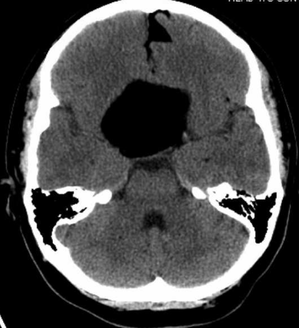 Dr. Mustafa K. Baskaya, MD tweet media