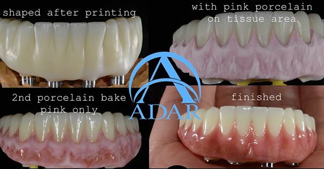 pinhasadar's tweet photo. Steps after designing a solid zirconia hybrid.⠀
call: (800)510-9286 email: info@adar.net⠀
⠀
#AdarDentalNetwork #PinhasAdar #DigitalDentistry #DominateDontCompete #AdarDental #PopInSmile® #GetTheLookOfAdar® #LHDDS #LarsHansson #AdarSuccessAcademy #Dom… https://t.co/MQi2oUHNfG https://t.co/PKHilsun59