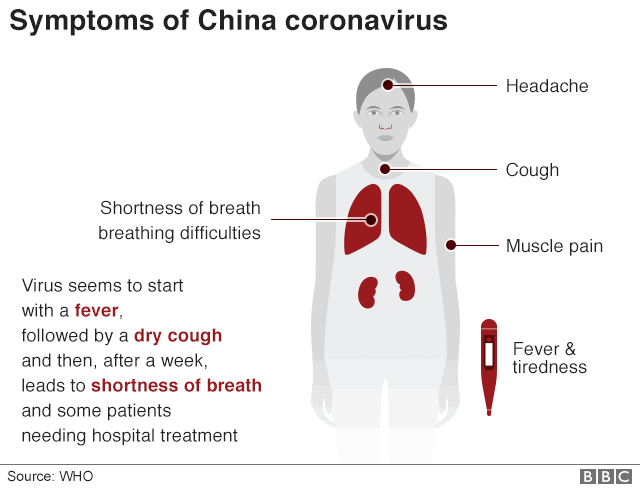 DataDude14's tweet photo. With accurate reliable data hard to come by it maybe as important to know the symptoms #Covid_19 #coronavirus #Italy https://t.co/LV1lUNuhex