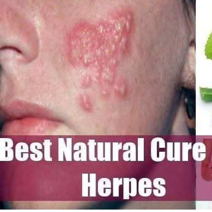 drakpan2's tweet photo. Natural roots and herbs that cure all manner of illness. Email; akpanherbalhelp@gmail.com
BCSM #LCSM #LYPHOMA #BTSM #PWME #CHILDHOODCANCER #PROSTRATECANCER #OVCA #AFIB #MIGRANE #SPINALCORDINJURY #COLONCANCER #DIABETES #PARKISONS #MENTALHEALTH https://t.co/HS3cpZB2lX