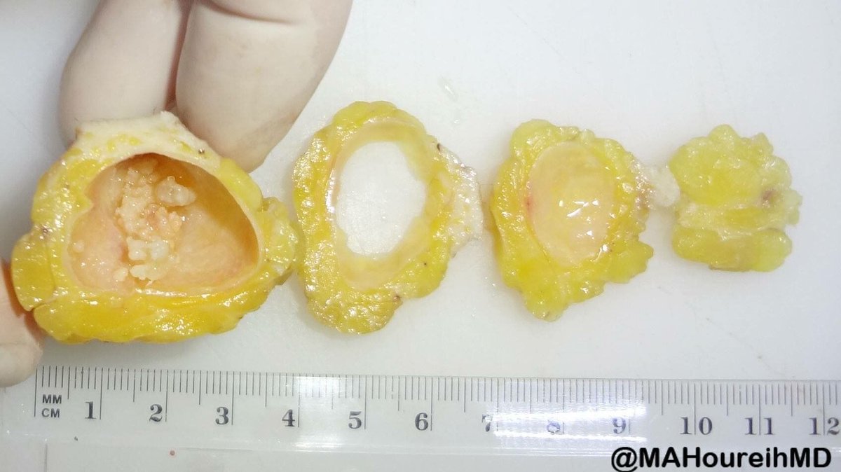 Jerad Gardner, MD tweet media