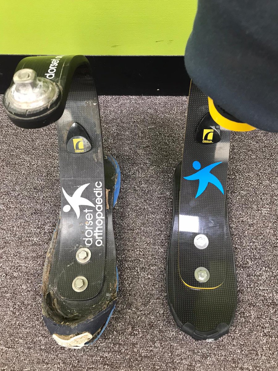 DorsetOrtho's tweet image. We had Colin in today to swap his old @OssurCorp blade for a nice shiny new one - along with a choice of colours for the Dorset Ortho logo #StriveForBetter