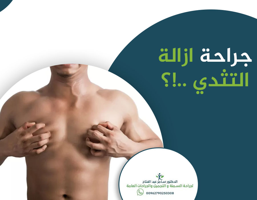 ما هي أنواع #جراحة_أزالة_التثدي؟
#النوع_الأول: إزالة التثدّي عن طريق شفط الدهون (غير فعالة في حالات التثدي الناتجة عن حدوث خلل في الهرمونات).
#النوع_الثاني: إزالة التثدي من خلال إستئصال الدهون والجلد الزائد من الثدي.
#الدكتور_سامر_عبدالفتاح
00962790250308
#تكميم #رابطة_المتكممين