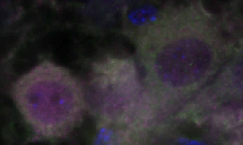 Really excited to be able to offer a fully funded PhD position in my group <a href="/StAndrewsBSRC/">BSRC St Andrews</a> <a href="/univofstandrews/">University of St Andrews</a> <a href="/SchoolofBiology/">School of Biology</a> working on Spinal Muscular Atrophy. Details bit.ly/38WSaPR or contact me for info.