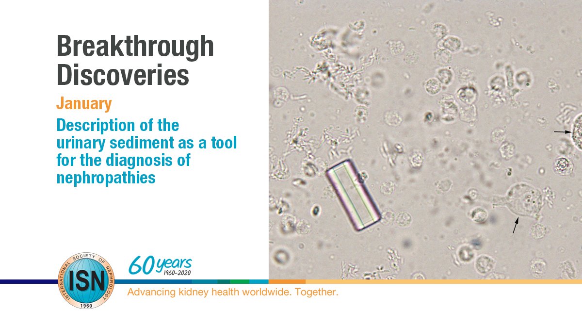  Description of the urinary sediment as a tool for the diagnosis of nephropathies https://www.theisn.org/60th-anniversary/breakthrough-discoveries/breakthroughs-in-january/description-of-the-urinary-sediment-as-a-tool-for-the-diagnosis-of-nephropathies  #ISN60years