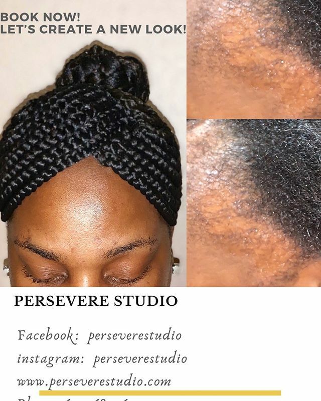 PersevereStu's tweet image. Book Now! 🤗No more struggle between styles🙅🏾‍♀️! #shouldvewenttotiff #alopecia #layerbraids  #tribalbraids #braids #hairlossbraider #2layerbraids #hairlossstylist #hairloss #columbusstylist #ifitaintcrispitaintbytiff #209braids #protectivestyles #columbusbraids #atlbraids #lahai…