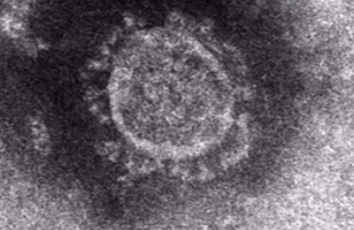 生物 兵器 肺炎 新型 新型コロナウイルスは生物兵器なのか？ 中国政権による細菌戦争の意図とその可能性を探る