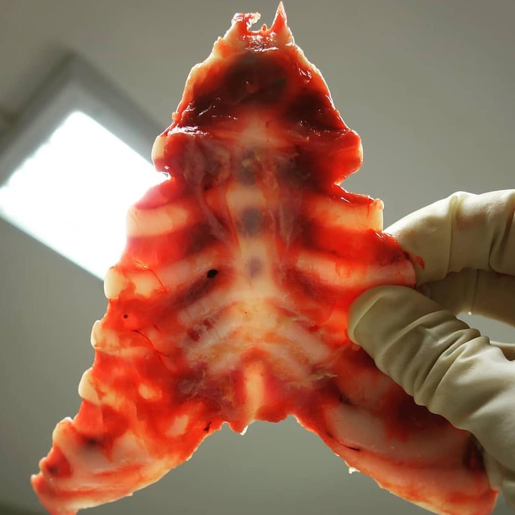 anatomiae_'s tweet image. Ossificação esternal de uma criança de 10 meses. O esterno é um osso laminar e articula-se com as clavículas e com as cartilagens costais dos sete primeiros pares de costelas.