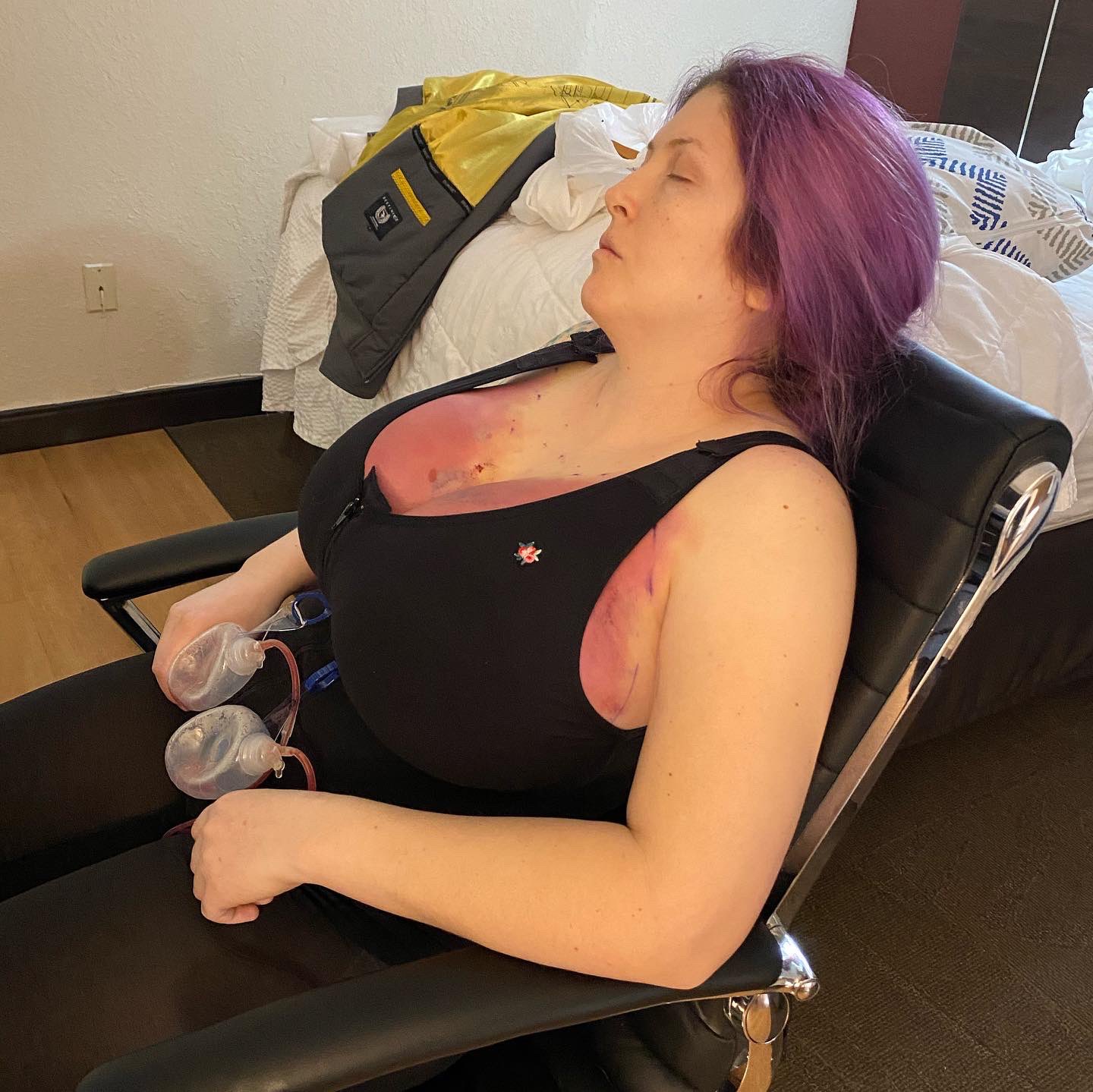 Demora Avarice on X: Few days old photos, I was pretty out of it then!  t.coeZ5qjKP9UV  X