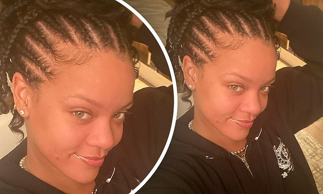 Rihanna Shows Off Shiny Pimple in First Selfie of the DECADE! http://bit.ly/39TlDuZย #Pimple #Rihanna #Selfie