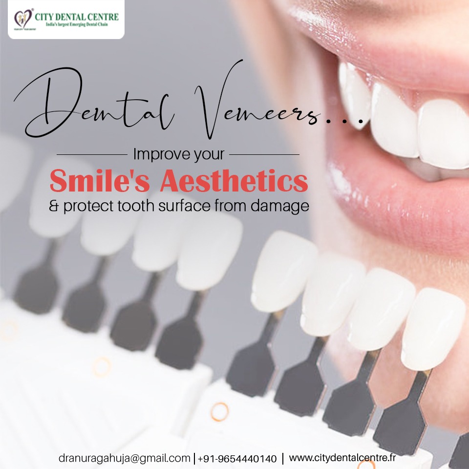 cdc_europe's tweet photo. Get your teeth appearance enhanced with dental veneers and flaunt a beautiful smile! Enquire now for custom made packages.
Call us – +91 9654440140
Visit: https://t.co/EzFER83Pd4
#CityDentalCentre #Teeth #Tooth #DentalCare #DentalProblems #Smileconfidently  #DentalTreatment https://t.co/TD2MvLuGKa