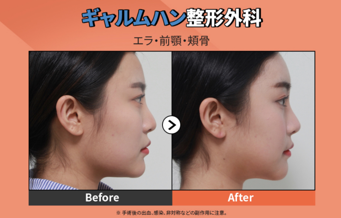 Allure 韓国美容ケアサポート Tobeyourallure Twitter