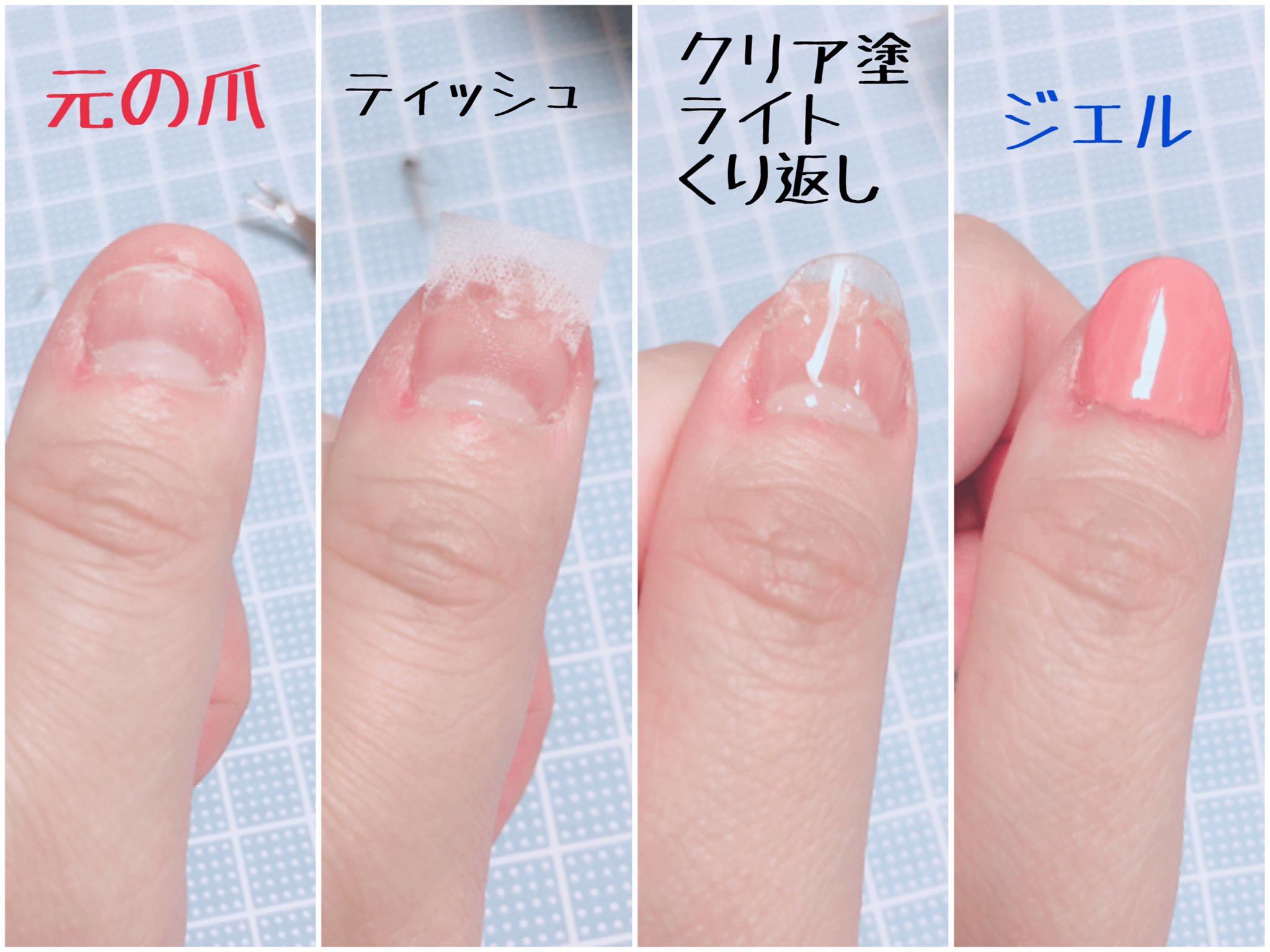 佐野涼 ඞ 造形の動画見てたら突然ティッシュで作る深爪野郎でも長さ足せるセルフジェルネイルのやり方見つけて その通りにやって見たら生まれてこの方ずっと深爪野郎だった爪が ある すごい これで爪噛みグセ直る人もいるらしーから全指やってみよかな 佐野涼 ඞ 造形の動画見てたら突然ティッシュで作る深爪野郎でも長さ足せるセルフジェルネイルのやり方見つけて その通りにやって見たら生まれてこの方ずっと深爪野郎だった爪が ある すごい これで爪噛みグセ直る人もいるらしーから全指やってみよかな