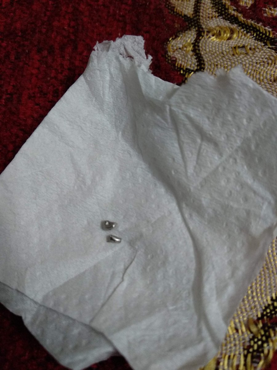 saizzz's tweet photo. @MKRetail1927 @fssaiindia @consumerforum_  We purchased this Best Harvest Kuthiraivali rice from M.K Retail Indiranagar and found 4 metal pieces inside the packet out of which two were found while eating. Is this how you ensure food safety? how do we trust your products now? https://t.co/g6mROjZcjC