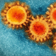 elzeer's tweet image. سبحان الله.
أصاب قرابة الـ80 ألف انسان ومات منه قرابة الـ2700 وأنتقل إلى 38 دولة وأغلق بينهم الحدود والتنقل وحجر على الناس وهبط اقتصاد العالم وخسرت الدول والشركات المليارات. كل هذا بسبب فايروس حجمه بالنانوميتر لا يرى بالعين أبدًا.

"وما يعلم جنود ربك إلا هو وما هي إلا ذكرى للبشر"