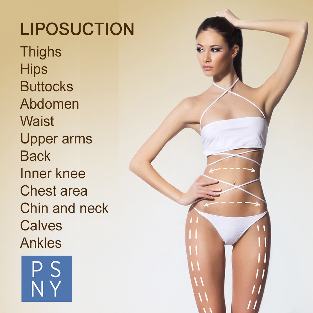 psofny's tweet image. 