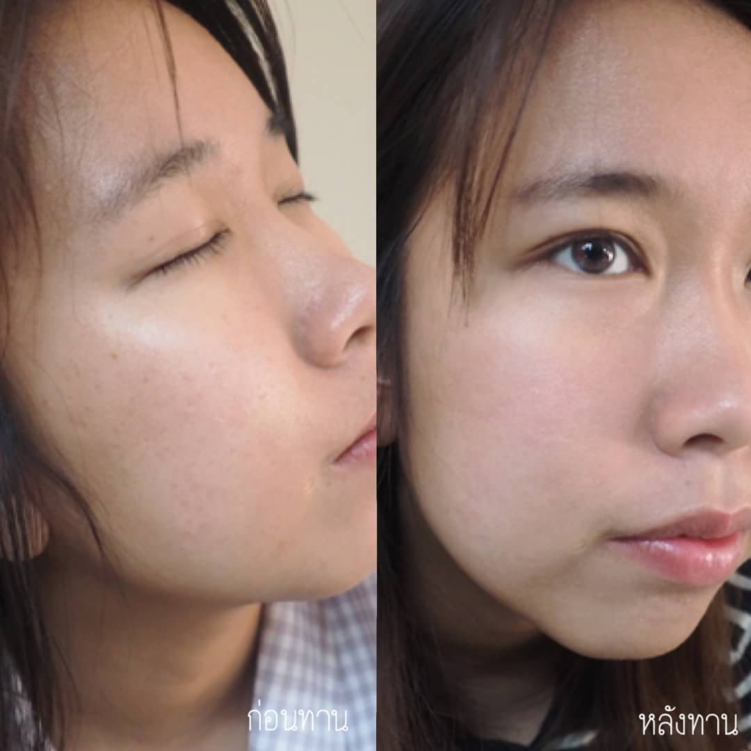reviewmuandskc's tweet photo. ปกติเวลา ปจด มาคือปวดท้องมาก แต่พอได้ลองกิน Secret Ex ไม่มีอาการปวดท้อง ปจด เลย แถมช่วยในเรื่องหน้าใสด้วย สิวไม่ขึ้นง่ายเหมือนเมื่อก่อน ทานง่าย อร่อยด้วย #SecretEx #น้ำชงรสมิกซ์เบอร์รี่ #ของดีบอกต่อ https://t.co/aY32dgtZql