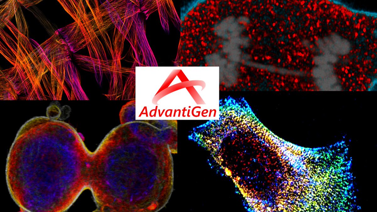 AdvantigenBio's tweet image. Planning some imaging studies? Our fluorophores allow for non-invasive, low background, real-time imaging. Unlike GFP/RFP-derived probes, our fluorophores don't require an oxygen co-factor enabling probing of anaerobic tissues. advantigenbio.com