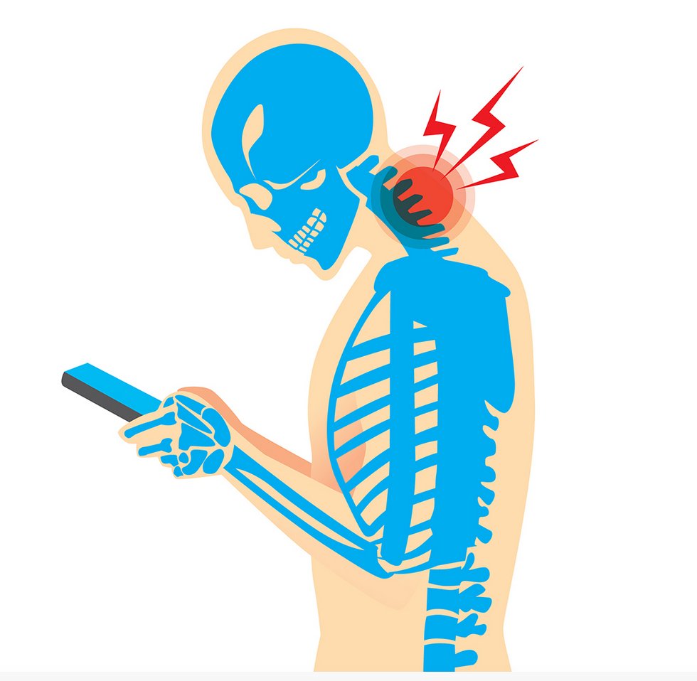 DunbarPhysio's tweet photo. Do YOU know that there’s something called “text neck syndrome”? You’ll probably want to learn more HERE: https://t.co/bXdFt9NNwP #texting #physiotherapy #healthtips #vancouver https://t.co/YVh82QU6aw