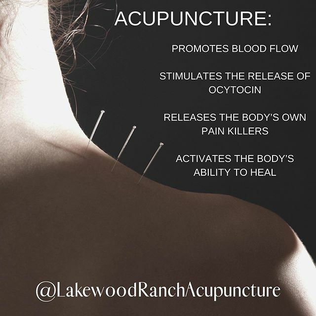 ......and much, much more. ☯️ #lakewoodranch #acupuncture #acupunctureworks #lakewoodranchacupuncuntureandwellness #naturaldoctor #doctoroforientalmedicine