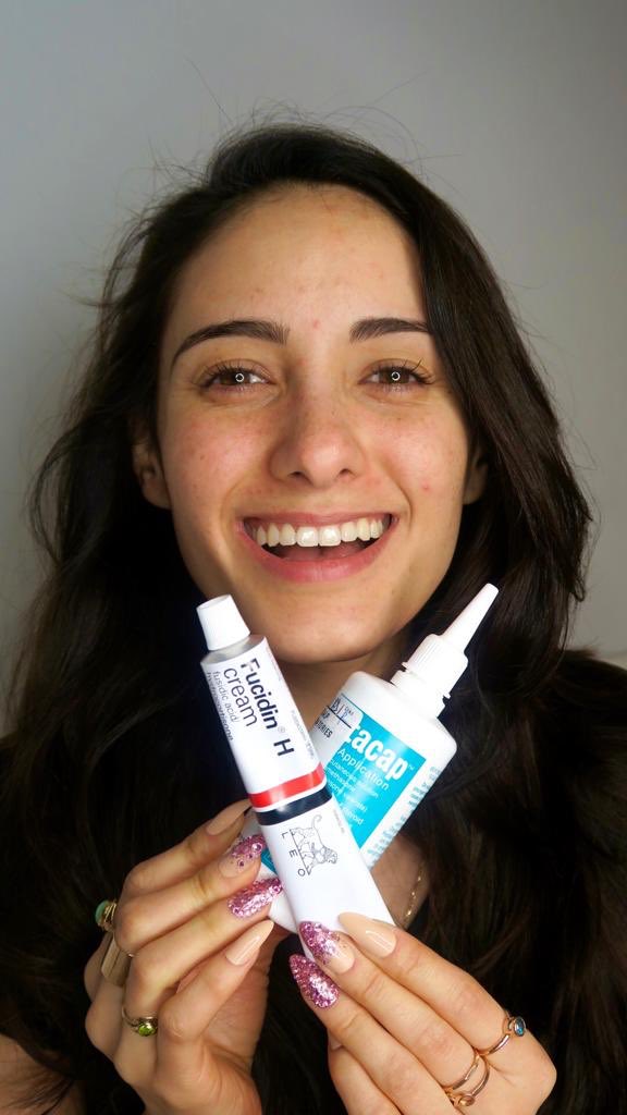 “I’m using the cream twice a day, and then using the cream in my hair once per day. I love my skincare, but I have to stick to this to try and get my eczema gone. This medication has definitely got rid of the scaleyness, and eczema under my eye has completely gone.” 0207 408 1164