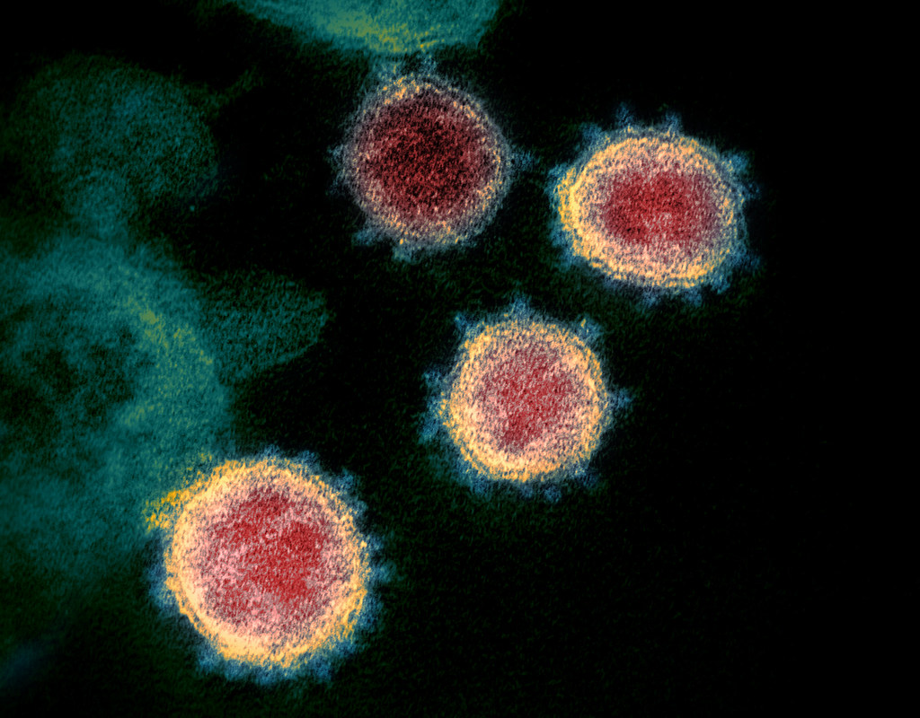 Atlas_Times's tweet photo. #Algeria: officials (Health Minister) announce 1st case of #coronavirus infection, Reported in the South at #Hassi_Messaoud Oil base; of an italian #ItalyCoronavirus  man infected with #cronavirus worked for energy firm 
@eni, https://t.co/JBG9CLseAi