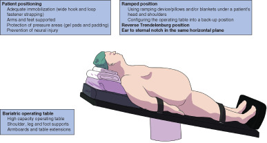 BJSurgery's tweet photo. In the BJS perioperative care special issue: Perioperative care of the obese patient https://t.co/wUNrUKka6N @JJEarnshaw @AmyLightnerMD @bplwijn @des_winter @JohnBeynon5 @ksoreide @MalinASund @evanscolorectal @robhinchliffe1 https://t.co/ysg2pW5V4j