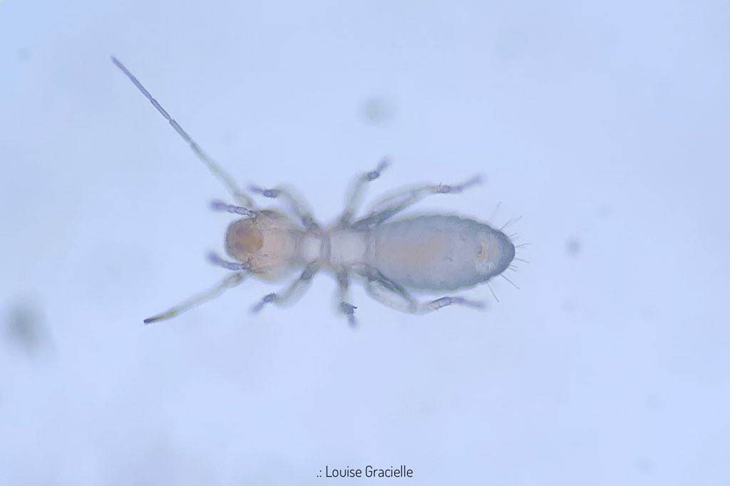 LouiseGracielle's tweet photo. Tiny visitor. And this one doesn’t shave. 🤭😂
#CrittersOnTwitter #UnderMyMicroscope #ADayInTheLab https://t.co/kRKz9Tj6gG