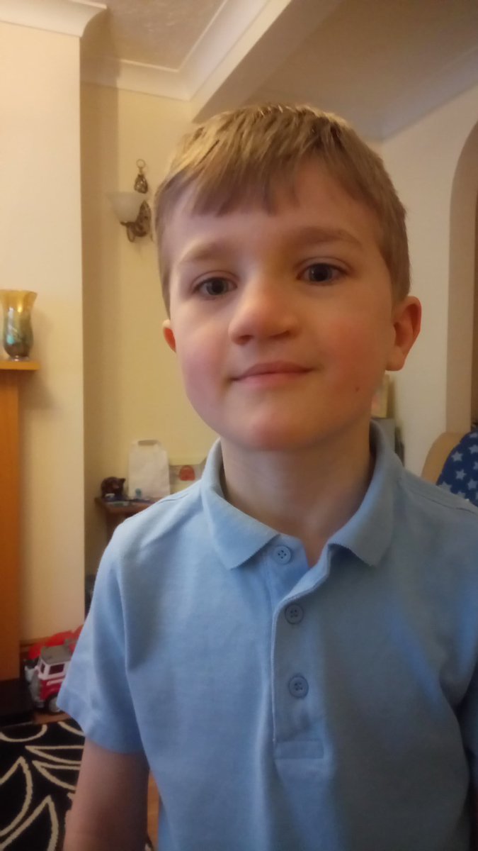 Andrew March (@marchypgagolf) on Twitter photo 6 years ago today we headed off to hospital with Logan for his first #cleft operation to repair the lip. Look where he is today with the amazing work from <a href="/ARMCobb/">Ali Cobb FRCS</a> and the SW Cleft team. <a href="/CLAPACOMMUNITY/">Cleft Lip and Palate Association</a> <a href="/BristolSWClapa/">Bristol Branch CLAPA</a> 6 years ago today we headed off to hospital with Logan for his first #cleft operation to repair the lip. Look where he is today with the amazing work from <a href="/ARMCobb/">Ali Cobb FRCS</a> and the SW Cleft team. <a href="/CLAPACOMMUNITY/">Cleft Lip and Palate Association</a> <a href="/BristolSWClapa/">Bristol Branch CLAPA</a>
