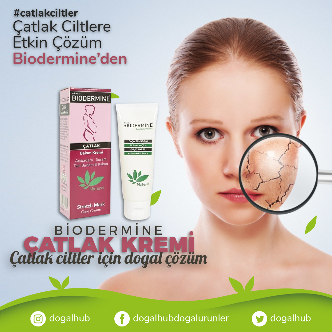 DogalHub's tweet photo. Değişim sırası size geldi bile😊 Şimdi karar verip başlayıp mutlu olma zamanı. Gebelik dönemi ve hızlı kilo alıp verme gibi durumlarda oluşan çatlaklar için hazırlanmış formülü sayesinde cildi besler ve nemlendirir. İçeriğindeki doğal bitki özleri çatlak oluşumuna engel olur👍🌿 https://t.co/eI9JJZc6Vp