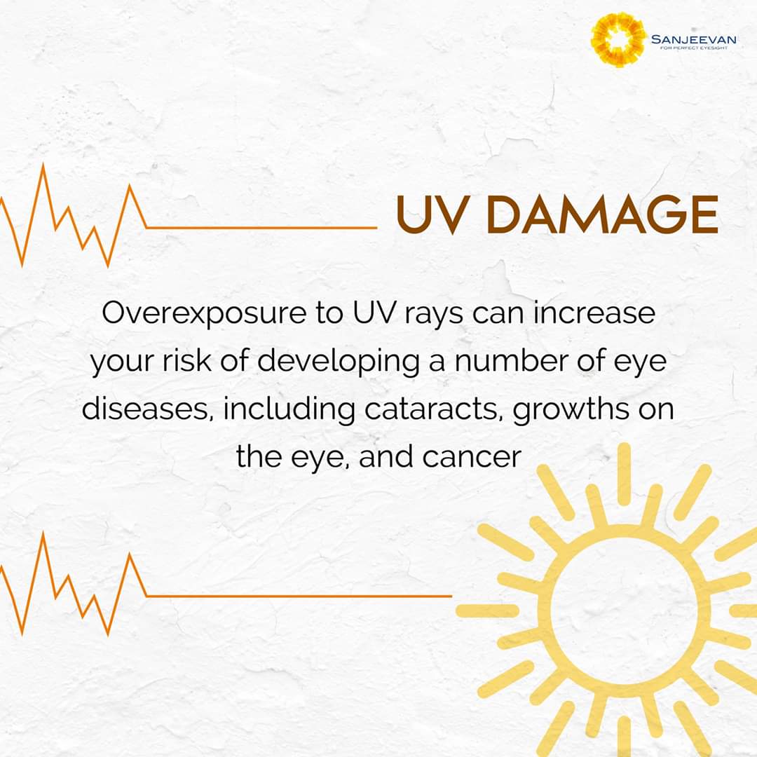 RealEyeOpener's tweet photo. Exposing your eyes to UV rays can harm your vision and cause eye issues such as cataracts, corneal sunburn, macular degeneration &amp; skin cancer around the eyelids. We all are always at a risk for eye damage from UV rays. 
To know more visit - https://t.co/wOnpx0JLaj

#Vision2020 https://t.co/VaDC0C6TLJ