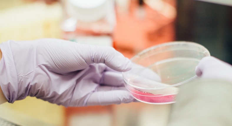 BeFoodTech's tweet image. Kweekvis als alternatief voor de visvangst ow.ly/BJ8x50ywcZH