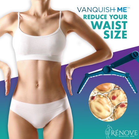 RenoveSpa's tweet photo. #WaistWednesday

Wanting to reduce your waist size? It could Possible, Painless, and easy-Peazy with #VanquishMe treatments! 😍

So, what are you waiting for?
Schedule a consultation today! 👇🏽
☎️ 346-200-8481

Visit our website for more info!
💻 https://t.co/wic4cIPPN7 https://t.co/Al5cx0waPq