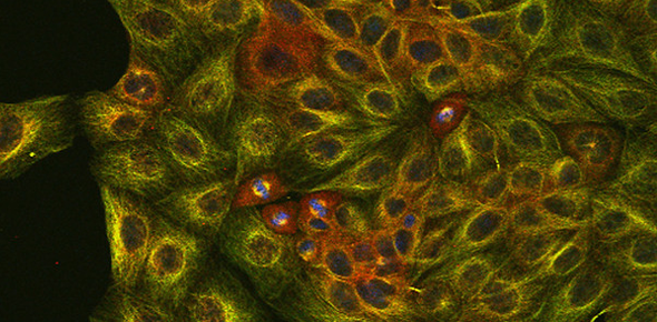 Cambridge_Fest's tweet image. Art and science, are they so different? Come and see where they converge at these #CamSciFest events:

The Cambridge LASER: sciencefestival.cam.ac.uk/events/cambrid…

Art and science for a future planet: sciencefestival.cam.ac.uk/events/art-and…

The art of scientific imaging: sciencefestival.cam.ac.uk/events/art-sci…