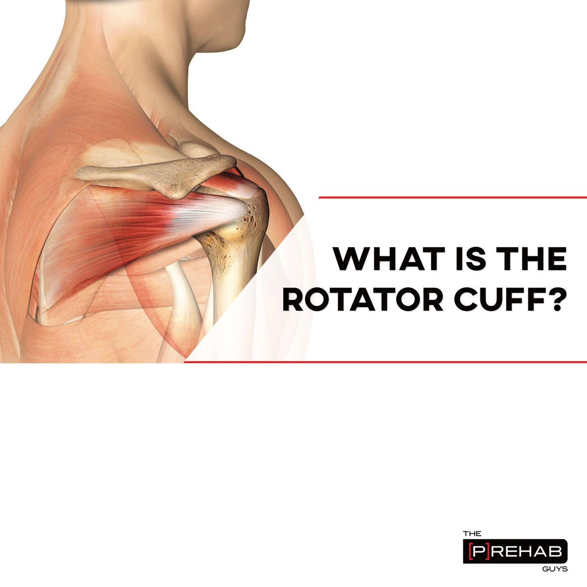 ThePrehabGuys's tweet photo. WHAT IS THE ROTATOR CUFF?

The rotator cuff is a group of 4 muscles and their associated tendons that span the shoulder joint, or more anatomically speaking, the glenohumeral joint. These muscles are... To read more click the link below!!

https://t.co/sHoj4k5kqE https://t.co/D1CslRa5an