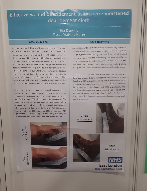 mediUKLtd's tweet photo. Have you popped over to see the posters at #woundcaretoday ?@WCTreport #ABPI #Hosiery #CompressionWraps #trustmedi #ProbablyTheBest #Debridement https://t.co/Dls1dTuk6r