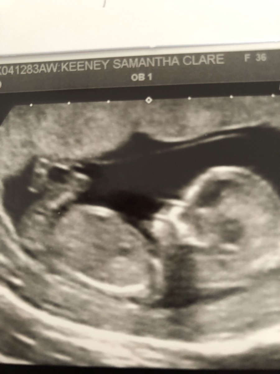 Scott Thorpe tweet media