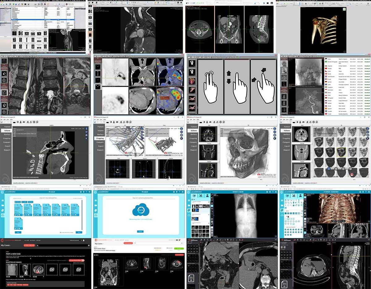 Radiology Cafe (@radiologycafe) on Twitter photo We have updated lourist of best Free DICOM viewers!
radiologycafe.com/radiology-trai…
#DICOM #PACS #radiology #radiologist
<a href="/HorosProject/">Horos Project</a> <a href="/radiantviewer/">RadiAnt DICOM Viewer</a> <a href="/StratovanCorp/">Stratovan</a> <a href="/postDICOM/">postDICOM</a> <a href="/CMRadiology/">Collective Minds®</a> We have updated lourist of best Free DICOM viewers!
radiologycafe.com/radiology-trai…
#DICOM #PACS #radiology #radiologist
<a href="/HorosProject/">Horos Project</a> <a href="/radiantviewer/">RadiAnt DICOM Viewer</a> <a href="/StratovanCorp/">Stratovan</a> <a href="/postDICOM/">postDICOM</a> <a href="/CMRadiology/">Collective Minds®</a>
