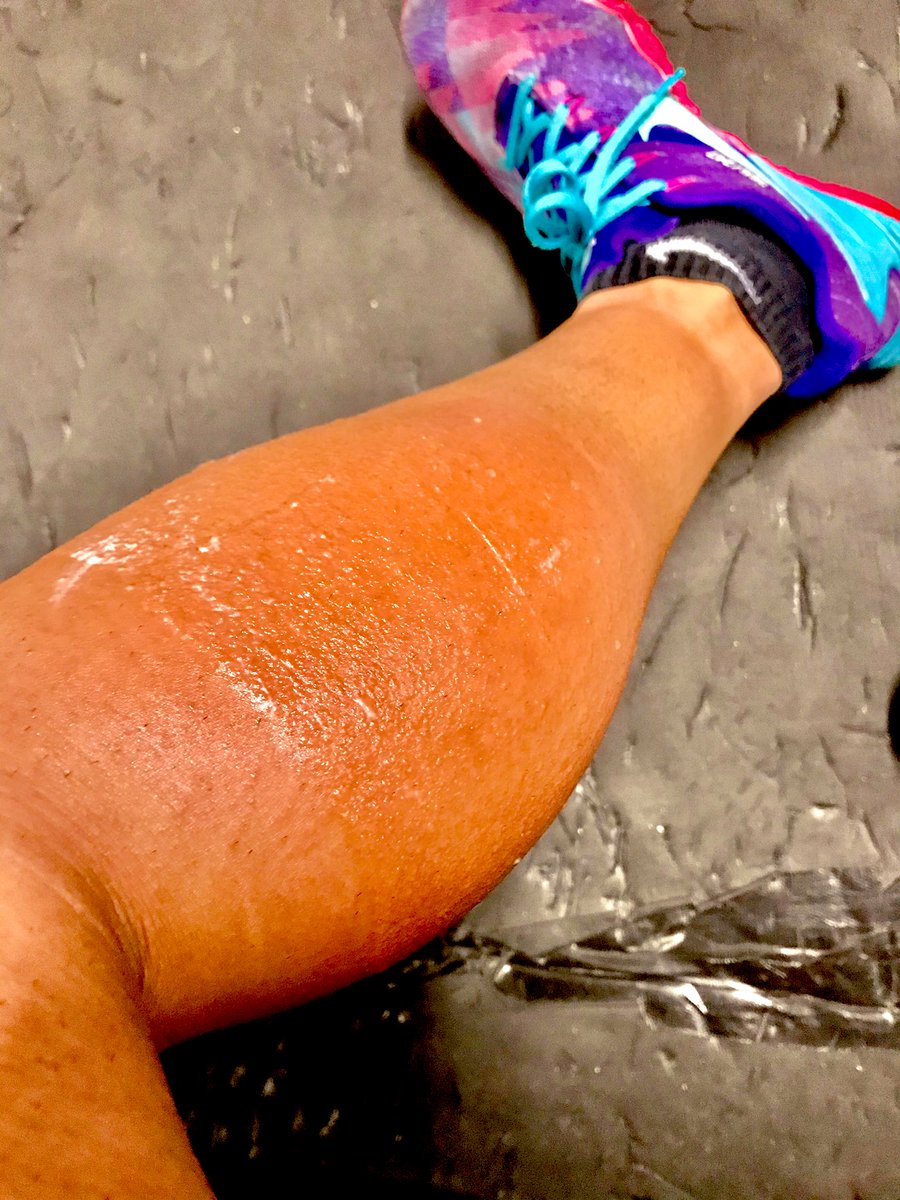 横須賀ススム Susumuyokosuka No Twitter Workout 終了 チカラが入ると時折り痛みはあったけど 特に問題なく出来ました 打った箇所の腫れ 皮膚がかぶれてしまってるダブルパンチ 汗 昨日 日焼け前に湿布を剥がして患部を洗ってから焼いたけど 浸透し