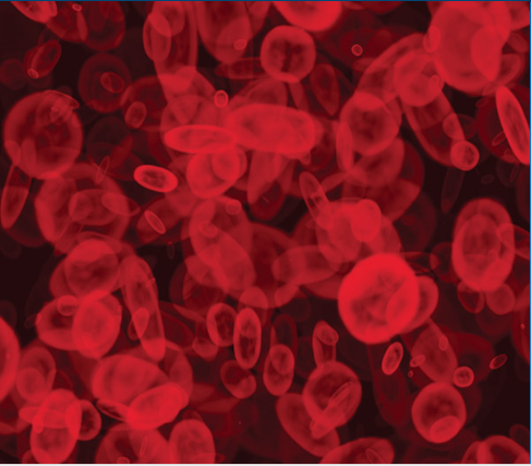 touchONCOLOGY's tweet photo. Recent Advances In The Treatment of #ChronicLymphocyticLeukemia, #DiffuseLargeBcell #lymphoma and #FollicularLymphoma; Authors: Ian W Flinn; Oncology & Hematology Review. 2018;14(2):63–4; Full free-to-access article available here: https://t.co/4ORpORcPAU
#lymphoproliferative https://t.co/16J9TH92Y7