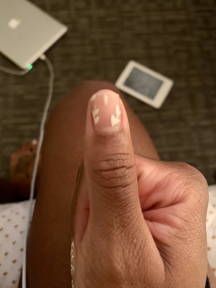 It took two and a half months, but my thumb nail is BYKE!