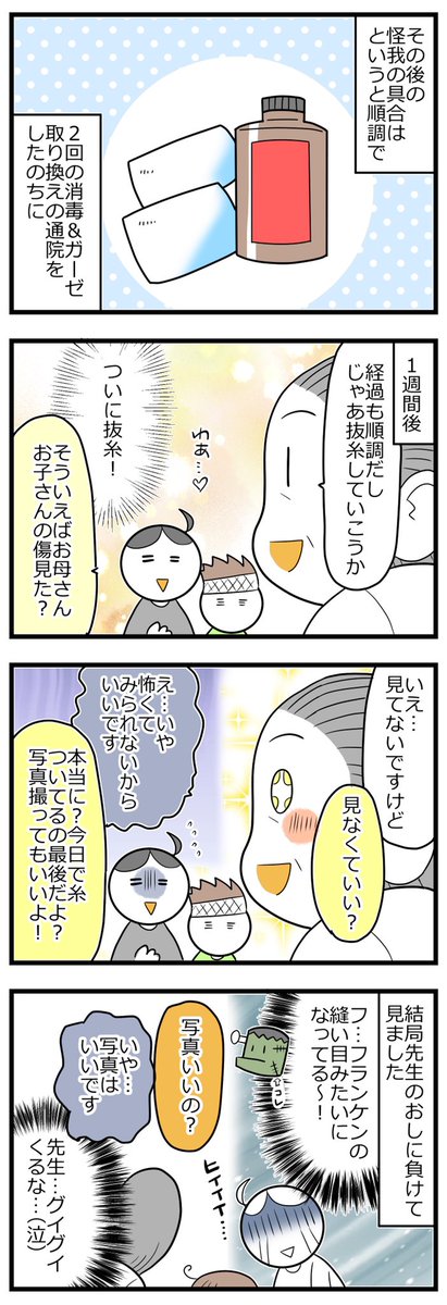頭を縫ったその後の話① #育児漫画 