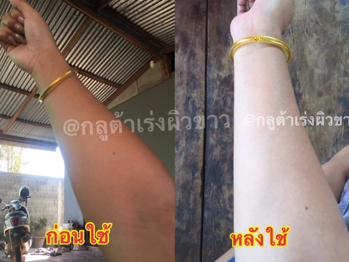 PinkGluta's tweet photo. #กลูต้าเร่งผิวขาว #หัวเชื้อกลูต้า
 🌸ผิวขาวกระจ่างใส

 🌸กระตุ้นการเกิดผิวใหม่

 🌸กักเก็บความชุ่มชื่น

 🌸ปกป้องผิวจากมลภาวะ

1กระปุก 290.- มีบริการเก็บปลายทางนะค่ะ https://t.co/Z6ZzebsvyI