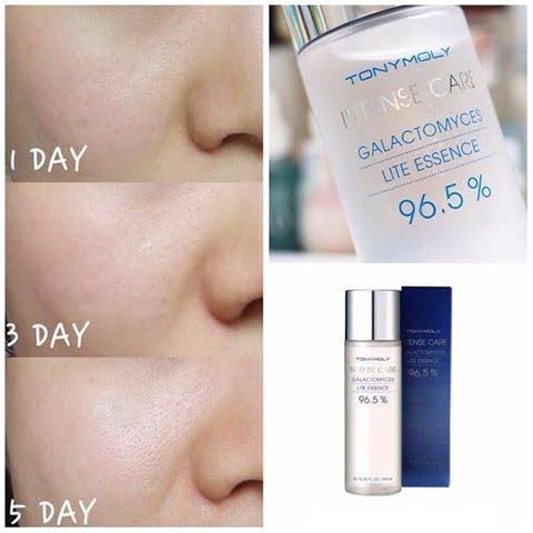 jeffbstore's tweet photo. 〰️ เปิดจอง 〰️
Tony Moly Intense Care Galactomyces Lite Essence 96.5% (120ml.) 

ราคาดีมากค่า 💦

✖️price : 250฿✖️

📌 จ่ายตอนของมา แต่ห้ามเทน้า 
📍มี 100 ขวดจ้า 
( รอของ 3-5 วัน ) https://t.co/OJ1dqOYHOx