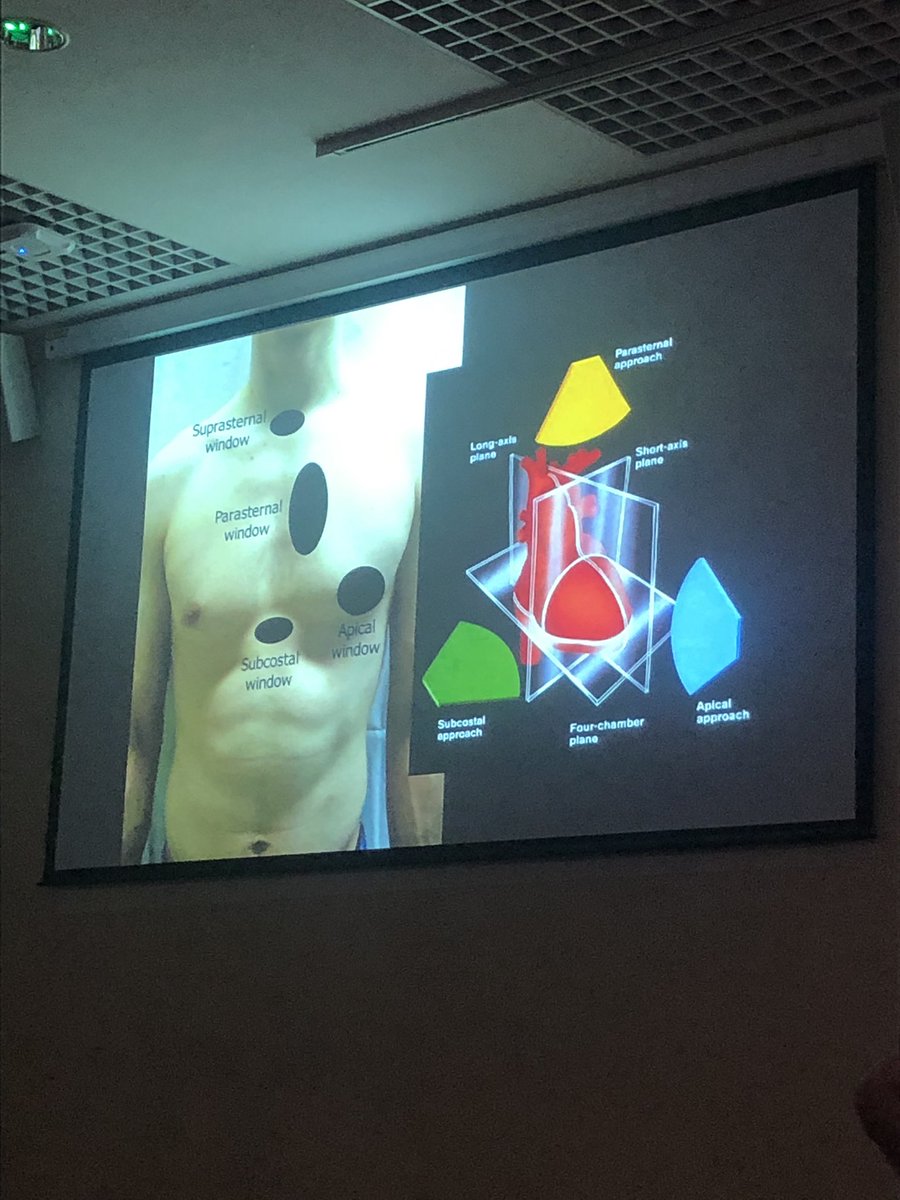 AccTedu's tweet photo. Core US course and echo in life support.  Subcostal view will get you most information for life support questions. #POCUS https://t.co/FicksalZWb