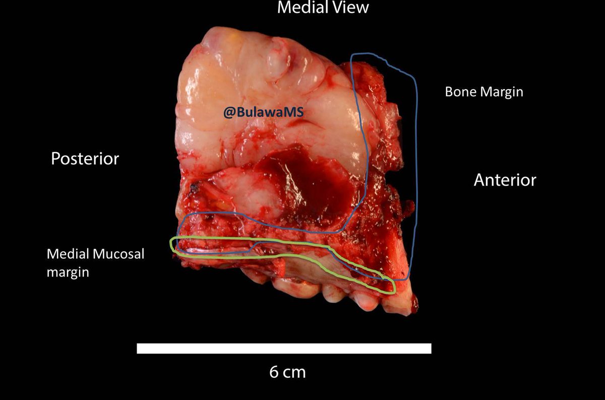 Lainee Bulawa, MS, PA (ASCP) tweet media