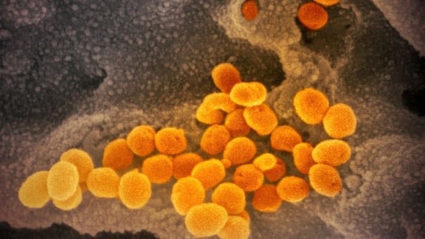 genmurchison's tweet photo. Here's what you need to know about how Manitoba is prepping for COVID-19
https://t.co/wrHtmGvMRx https://t.co/YZh5AlWNzx